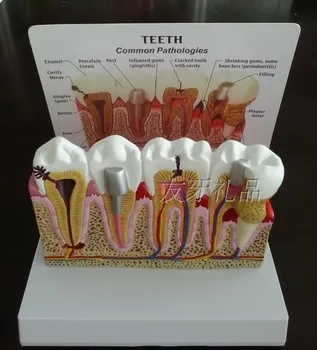 Nuimamas Dantų anatomijos modelis Odontologija, Burnos modelis 16.5*12.8*11CM nemokamas pristatymas